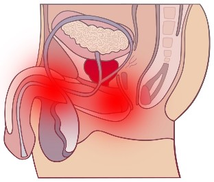 the prostate gland